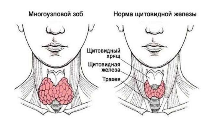 Лечение нарушений размеров органа